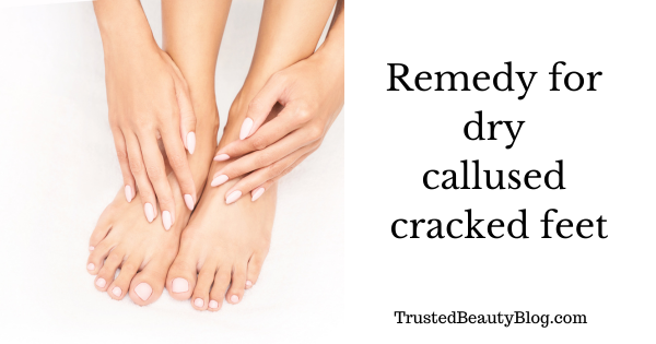 remedy for dry callused cracked feet